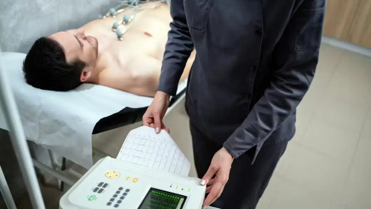 electrocardiogramme ecg fes